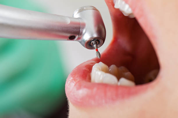 Best Emergency Cosmetic Dentistry in Fetters Hot Springs Agua Liente, CA